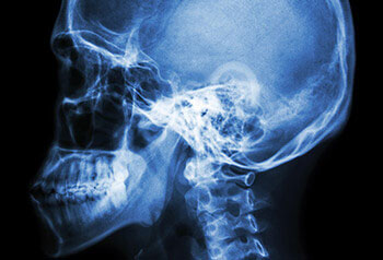 Craniofacial X-ray